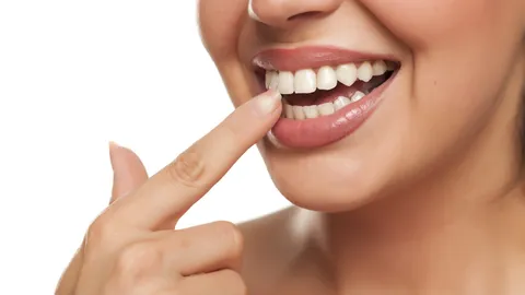Dental Calculus Causes & Treatment