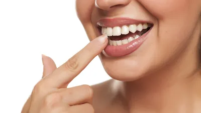 Dental Calculus Causes & Treatment