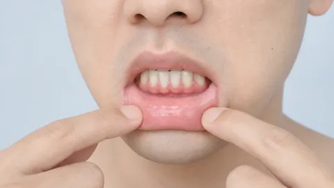 Inside Lip Tattoos: Pain, Cost, Healing, and Risks