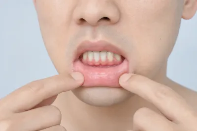 Inside Lip Tattoos: Pain, Cost, Healing, and Risks