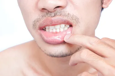 Inside Lip Tattoos: Pain, Cost, Healing, and Risks