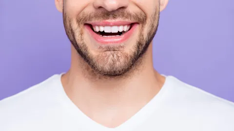 Are Veneers Painful?