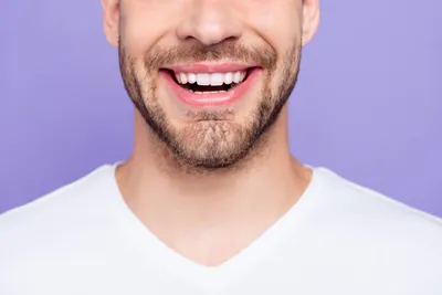 Are Veneers Painful?