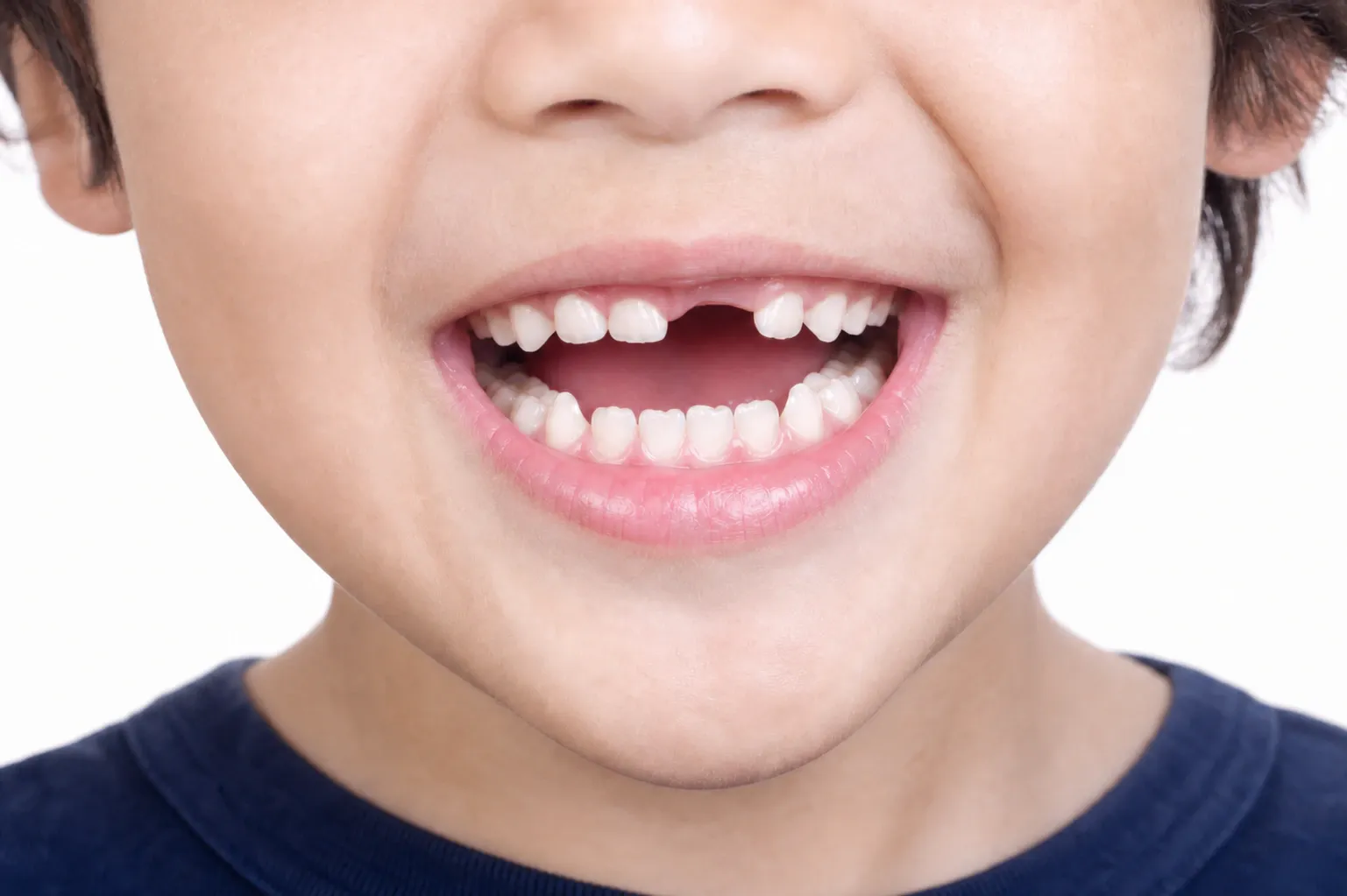 Cropped shot of a smiling little boy showing his baby teeth nm 1331