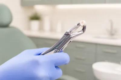 Tips to Prevent Dry Socket After Tooth Extraction