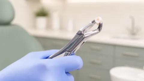Tips to Prevent Dry Socket After Tooth Extraction