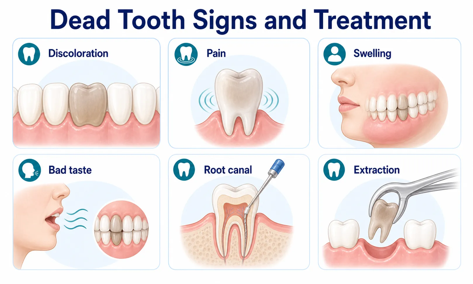 Dead tooth signs treatment options v2