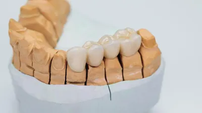 Types of Teeth: Molars