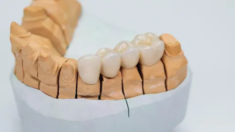 Types of Teeth: Molars