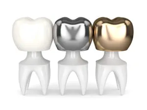 Dental crowns NewMouth