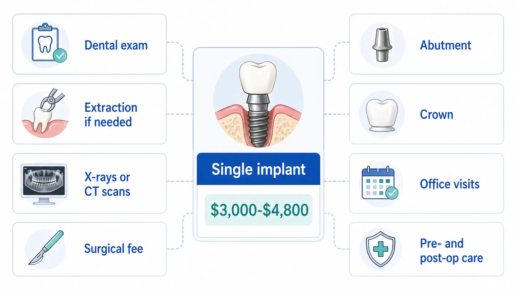 Dental implant cost factors v1