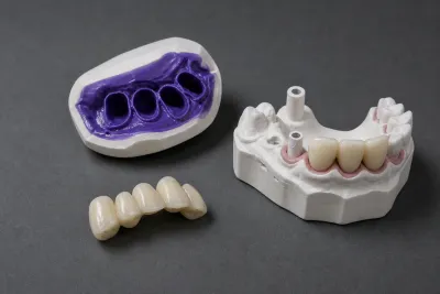 Stainless Steel Crowns: What They Are and How They Work