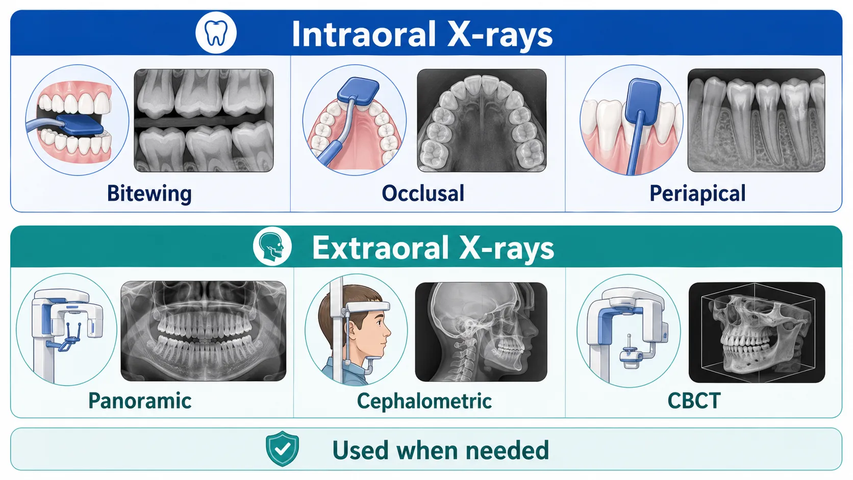Dental xray types board v1