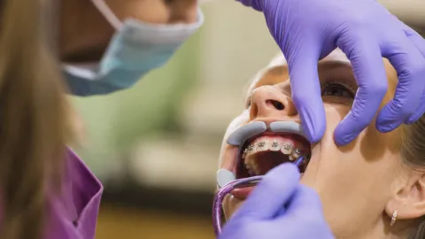 Orthodontic Headgear: Types & When Treatment is Necessary