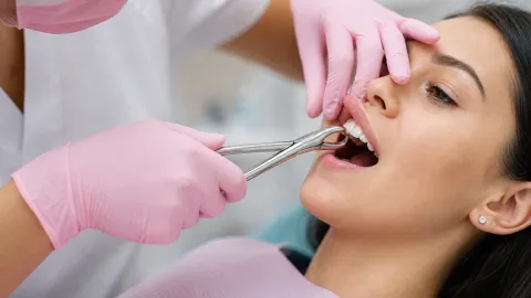 Emergency Tooth Extraction