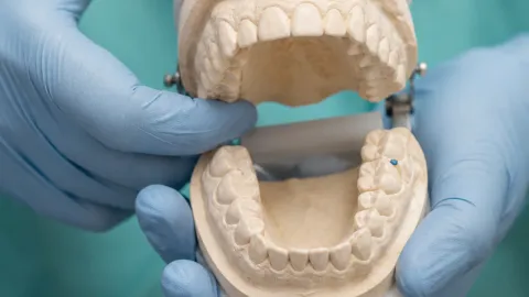 What to Do With a Chipped Tooth