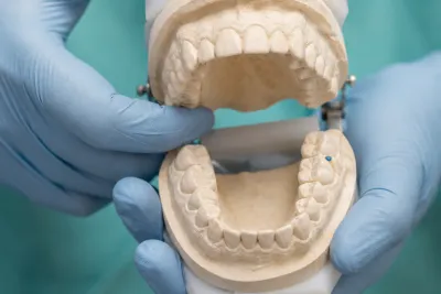 What to Do With a Chipped Tooth