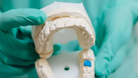 What to Do With a Chipped Tooth