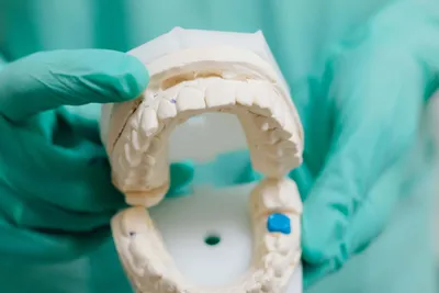 What to Do With a Chipped Tooth