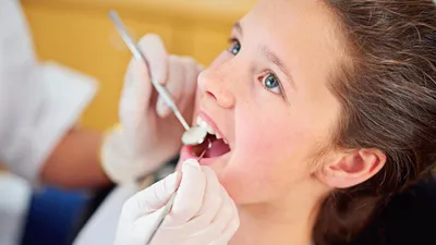 Space Maintainers: Why Your Child Might Need One