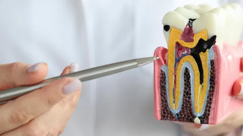 Cavity vs. Stain: How to Tell the Difference