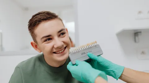 The 4 Different Types of Dental Veneers