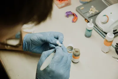 Composite Veneers: Costs, Procedure, Pros, and Cons