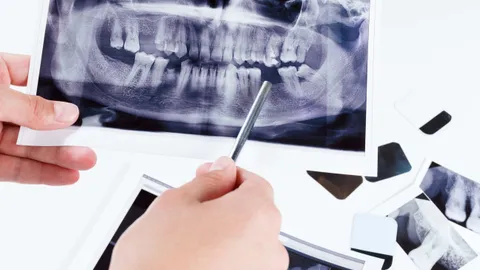 What Are My Options for Replacing a Lost Tooth?