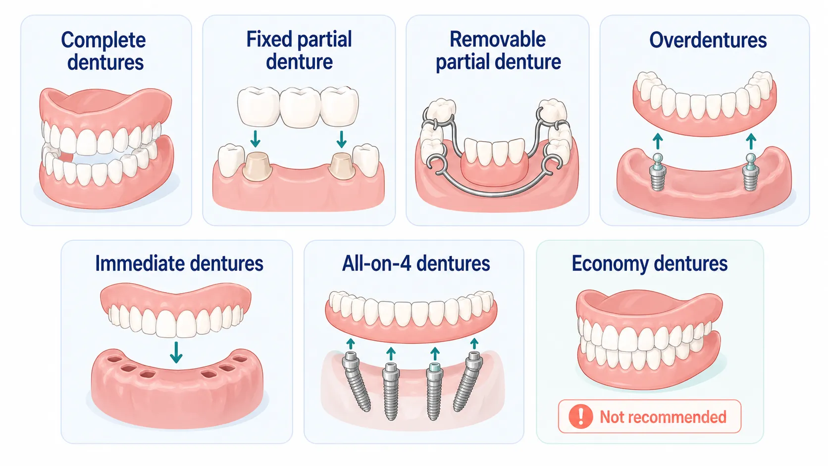 Denture types comparison v1