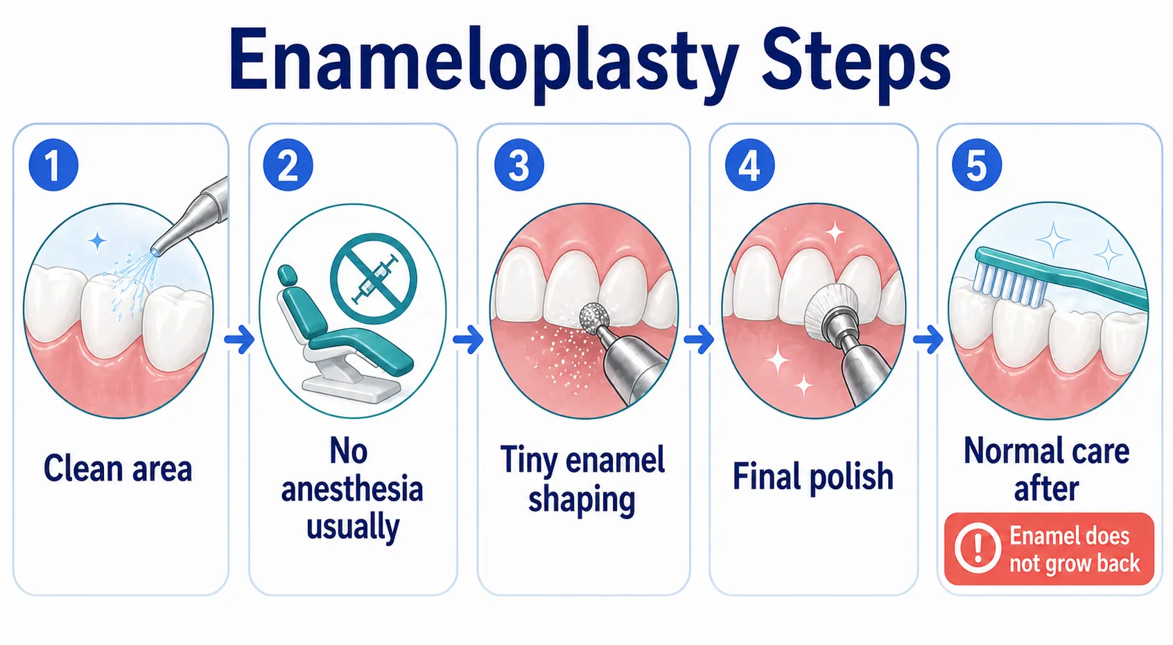 Enameloplasty procedure workflow v1