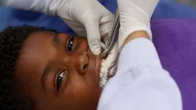 Tooth Extraction Cost