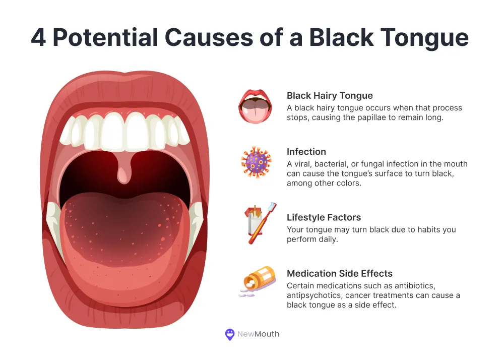 Four potential causes of a black tongue