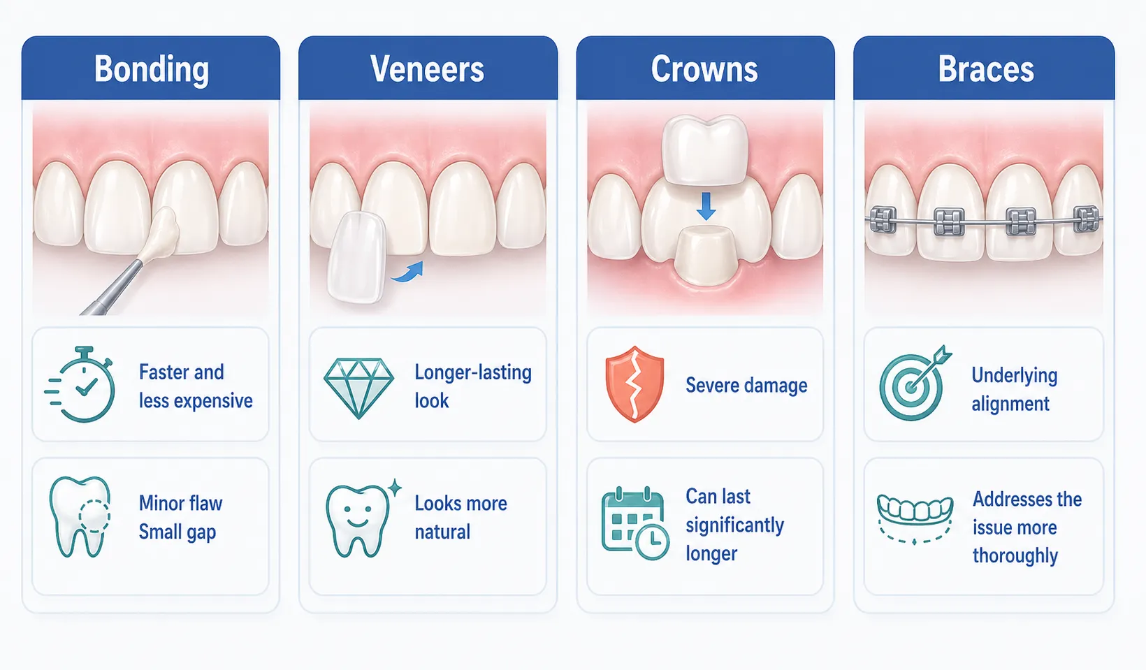 Front tooth bonding alternatives comparison v1