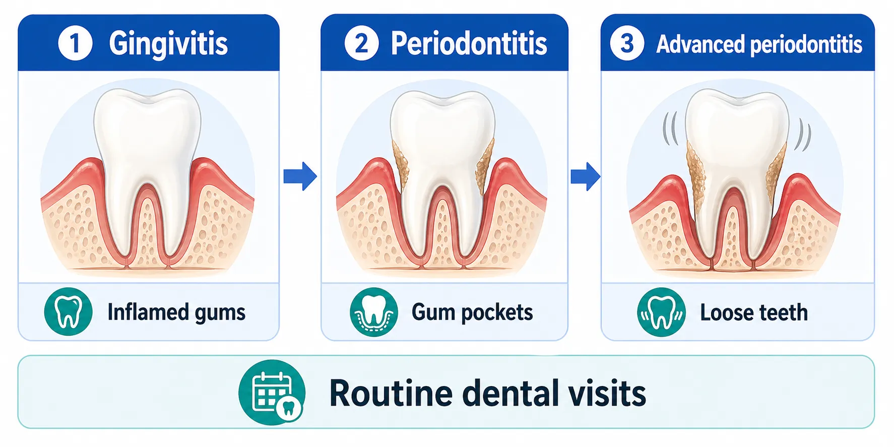 Gum disease stages board v1