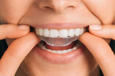 How to Use Crest White Strips
