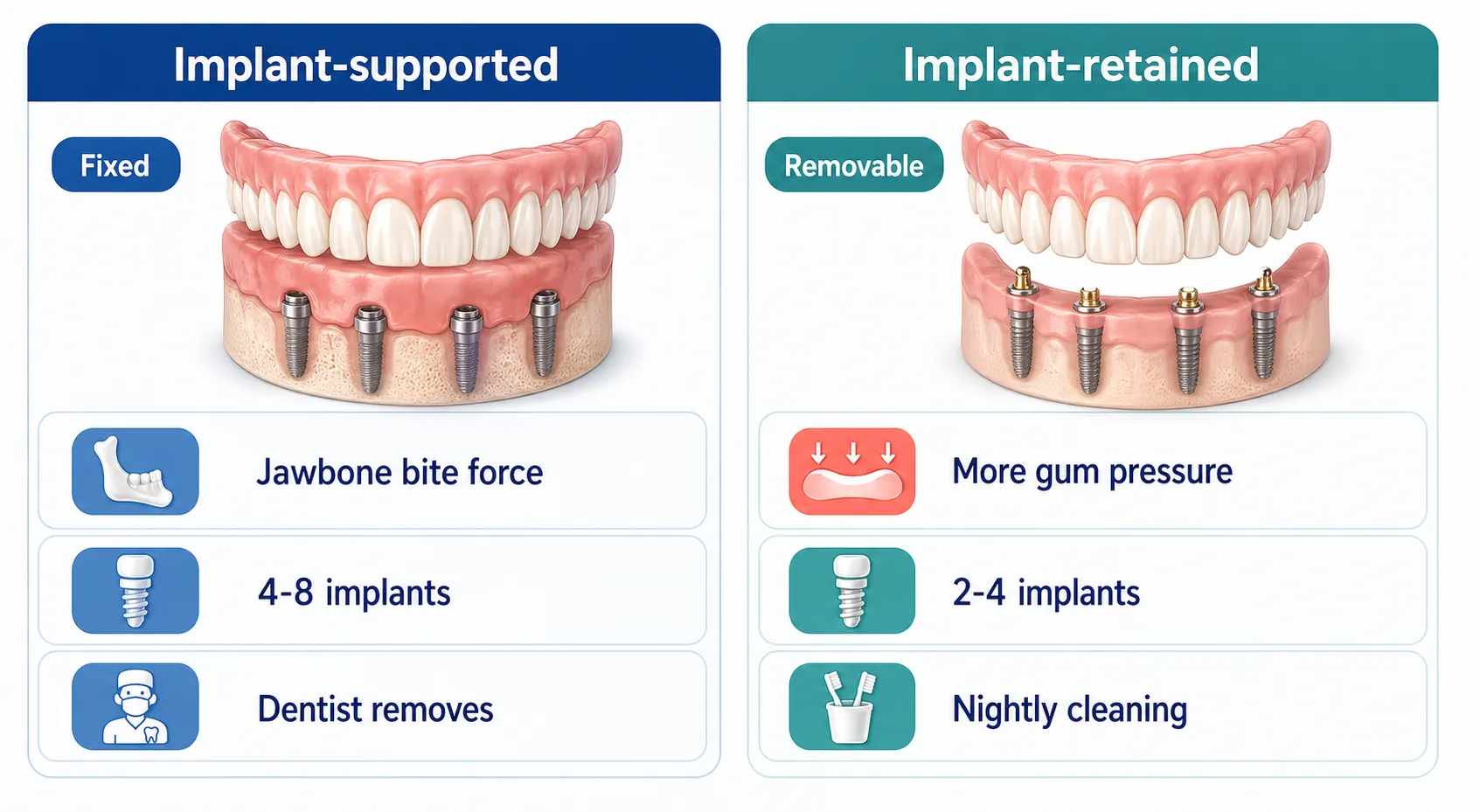 Implant supported vs retained dentures v1