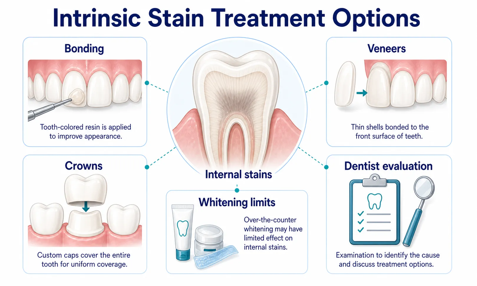 Intrinsic stain treatment options v1