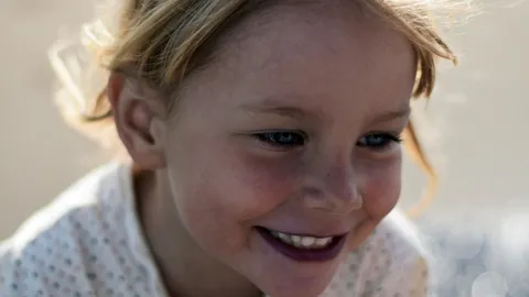 What Is Silver Diamine Fluoride, SDF?