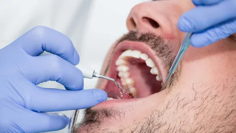 Black Spot on Tooth - Causes, Symptoms & Treatments