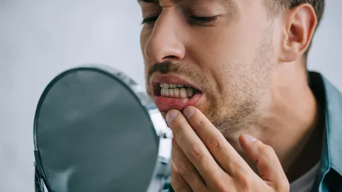 White or Pale Gums - Causes, Remedies & When to See a Dr.