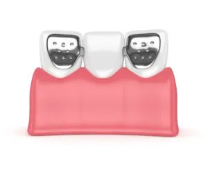 Maryland bridge NewMouth