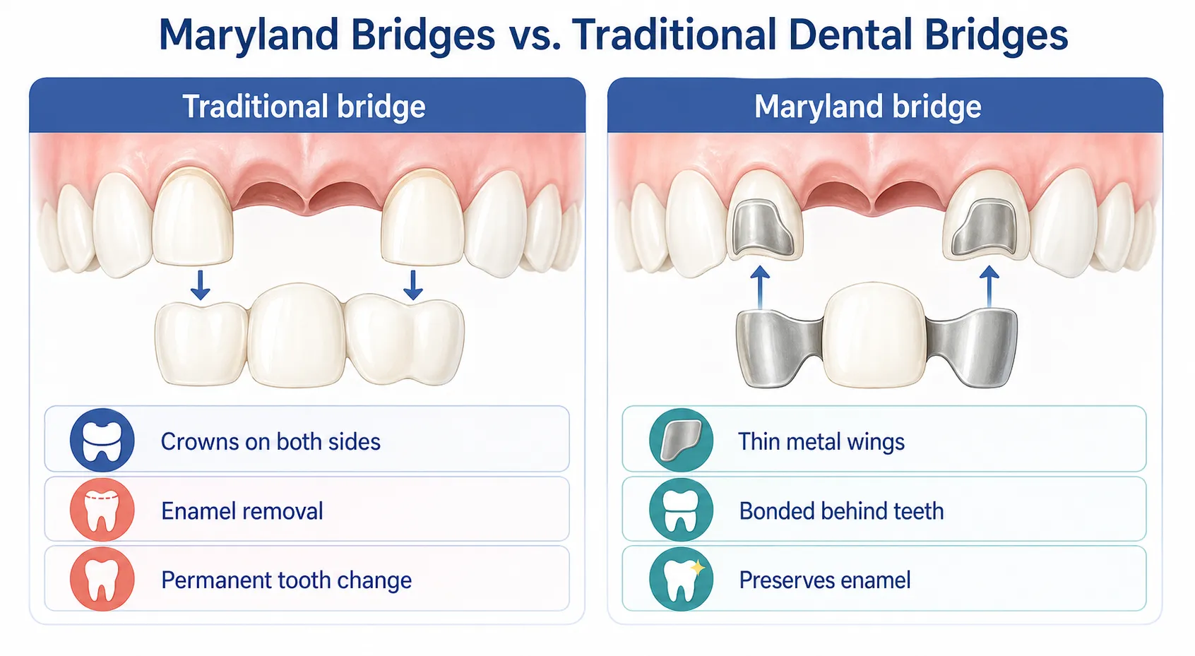 Maryland vs traditional bridge comparison v1