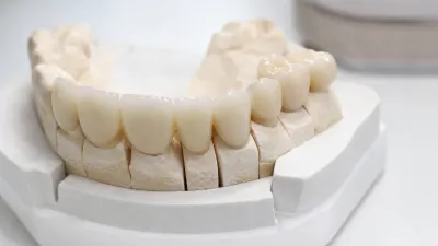 Loose Crown
