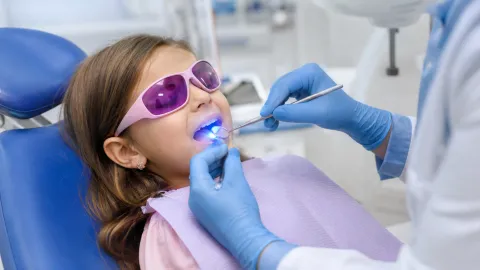How Long Do Dental Fillings Last?