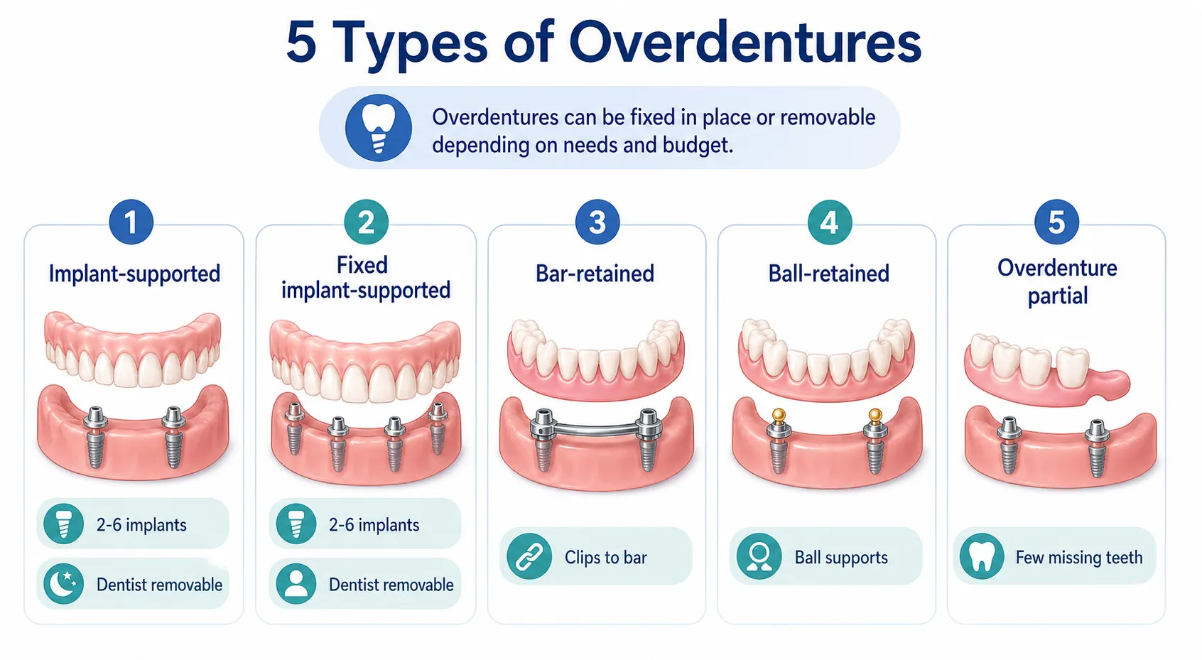 Overdenture types board v1