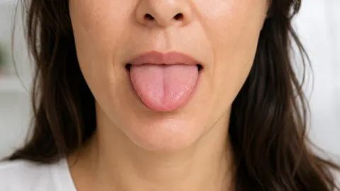 Numbing/Tingling Tongue