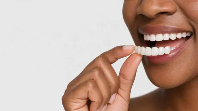 Pop On Veneers Review (2026)
