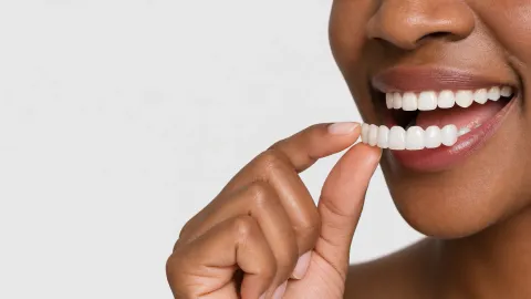 Pop On Veneers Review (2026)