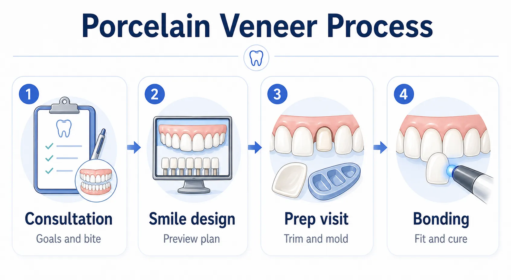 Porcelain veneer process workflow v1