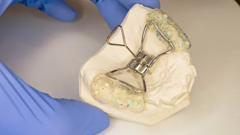 Palatal Expanders: Purpose, Procedure, and Health Benefits